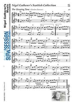 The Sleeping Tune